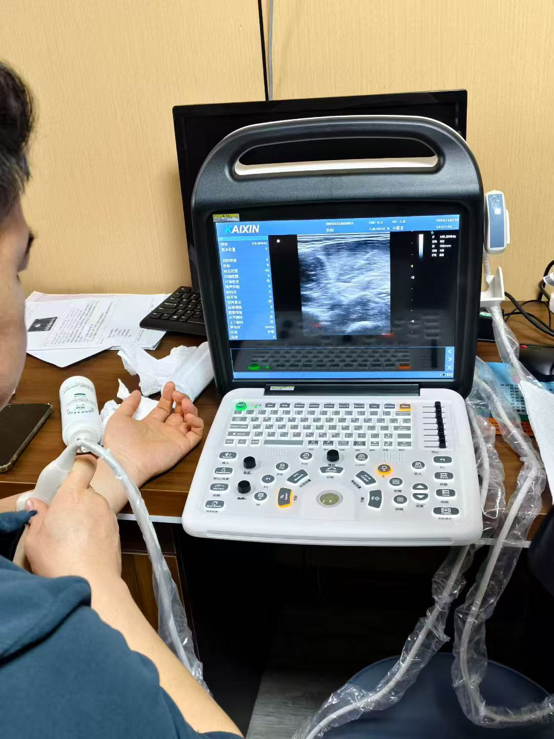 什么是肌骨超声