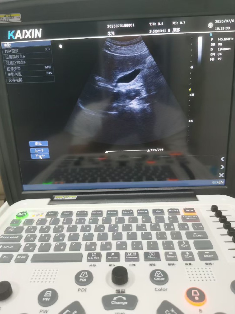 做腹部检查时要不要憋尿