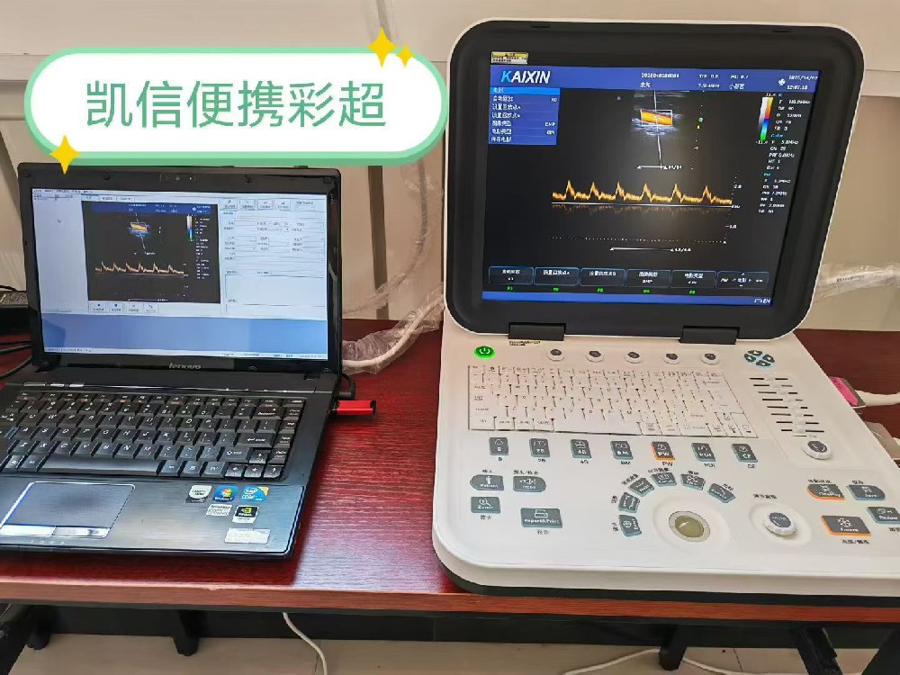 床旁彩超和普通彩超区别