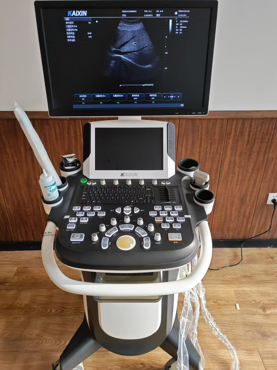 阴式彩超有哪些优势